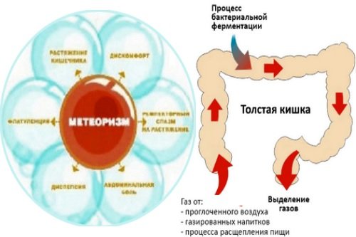 Gazoobrazovanie-v-kishechnike