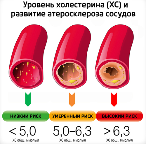 Уровень холестерина