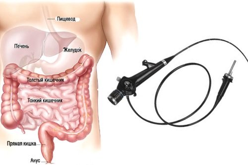 Jendoskopija-kishechnika