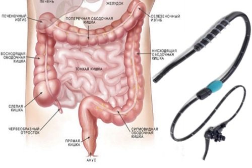 Jenteroskopija-kishechnika