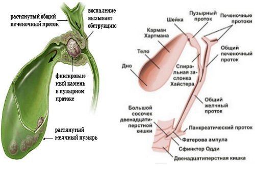 Kamni-v-zhelchnom-puzyre