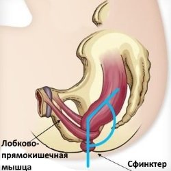 Nepravilnaja-poza