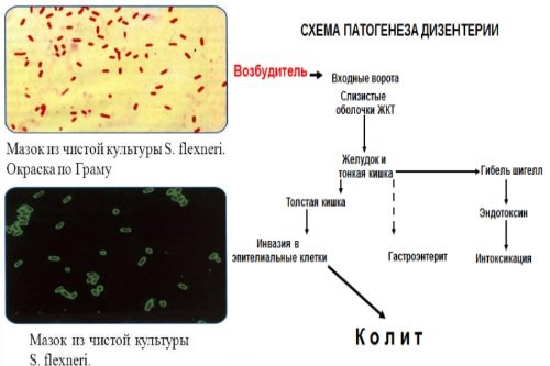 Patogenez-dizentirii