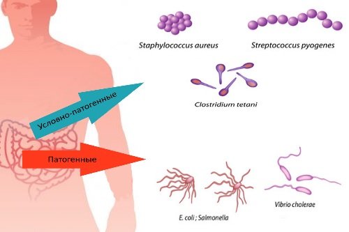 Patogennaja-i-uslovno-patogennaja-mikroflora