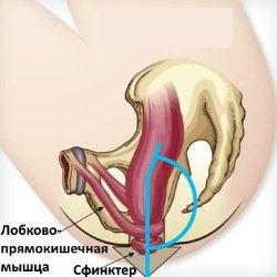 Pravilnaja-posadka-pri-oporozhnenii