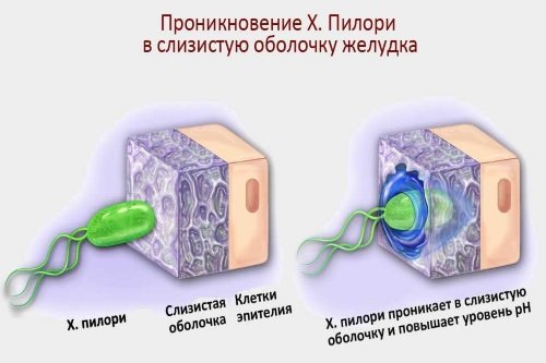 Proniknovenie-helikobakter-pilori-v-slizistuju-zheludka