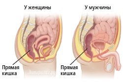 Raspolozhenie-prjamoj-kishki