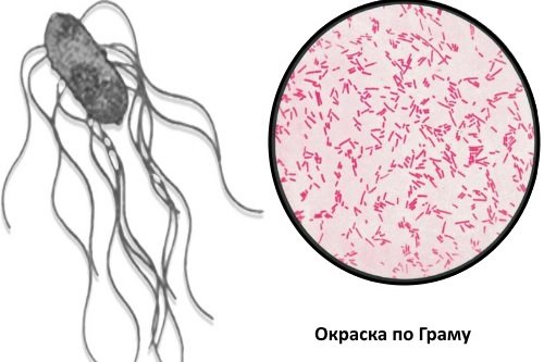 Salmonella-okraska-po-Gramu