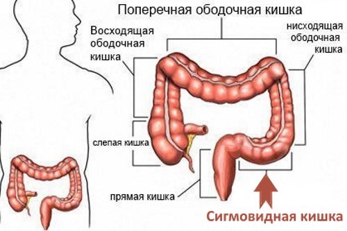 Sigmovidnaja-kishka-raspolozhenie