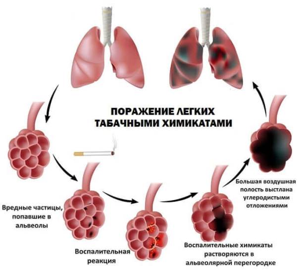 Как долго смолы и никотин выводятся из легких