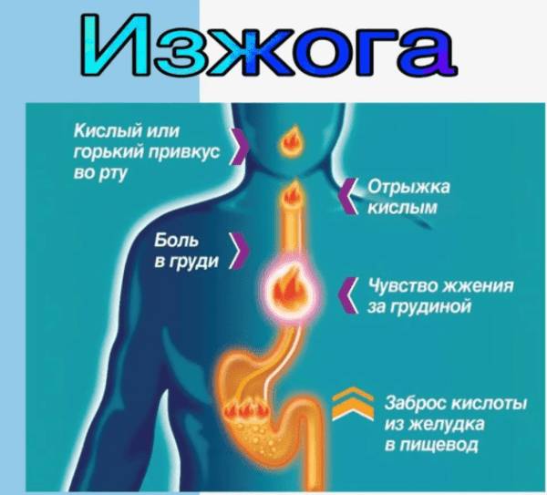 Причины и явные изменения при изжоге в организме человека