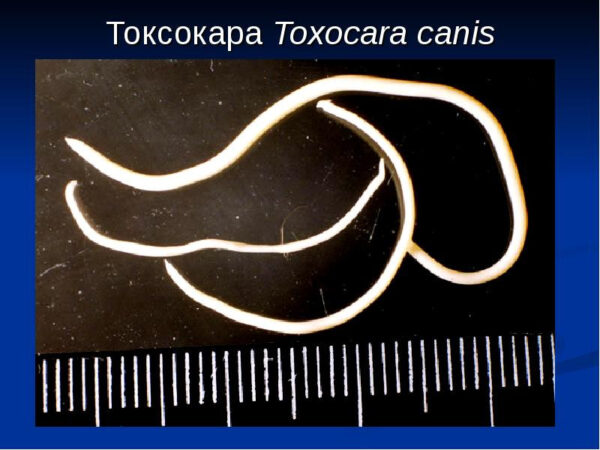 Токсокары у человека