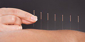 Иглотерапия польза