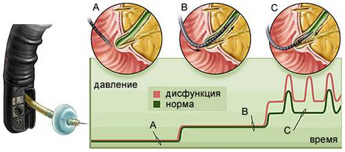 Манометрия