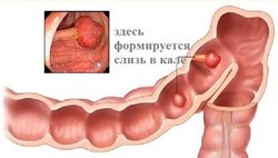 Первые симптомы рака