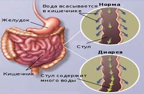 Что такое диарея