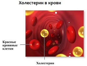 Холестерин в крови