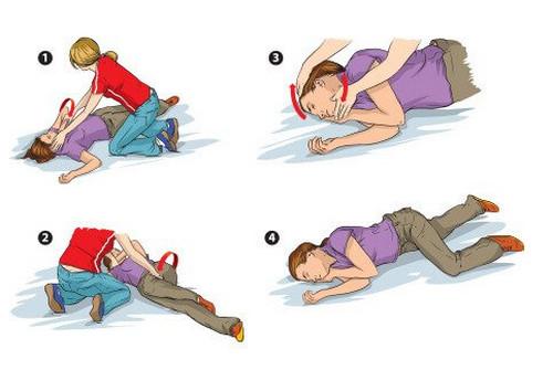 Неотложная помощь при судорожном синдроме