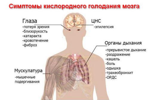 Гипоксия головного мозга - симптомы