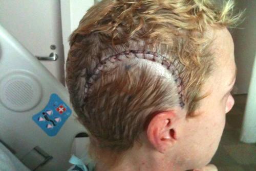 Диагностика глиобластомы головного мозга