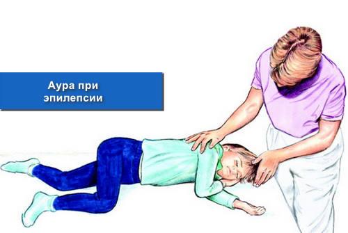 Аура при эпилепсии
