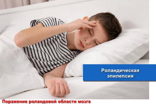 Роландическая эпилепсия у детей