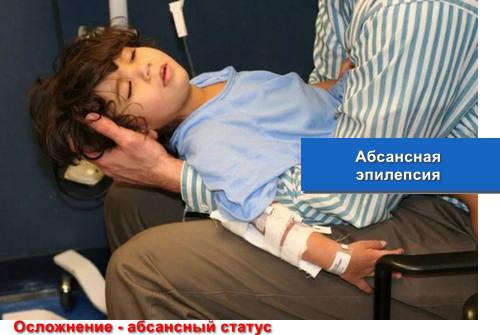 Абсансная эпилепсия у детей