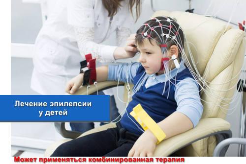 Лечение эпилепсии у детей