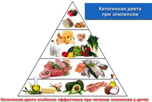 Кетогенная диета при эпилепсии