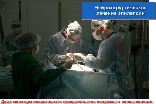 Нейрохирургическое лечение эпилепсии