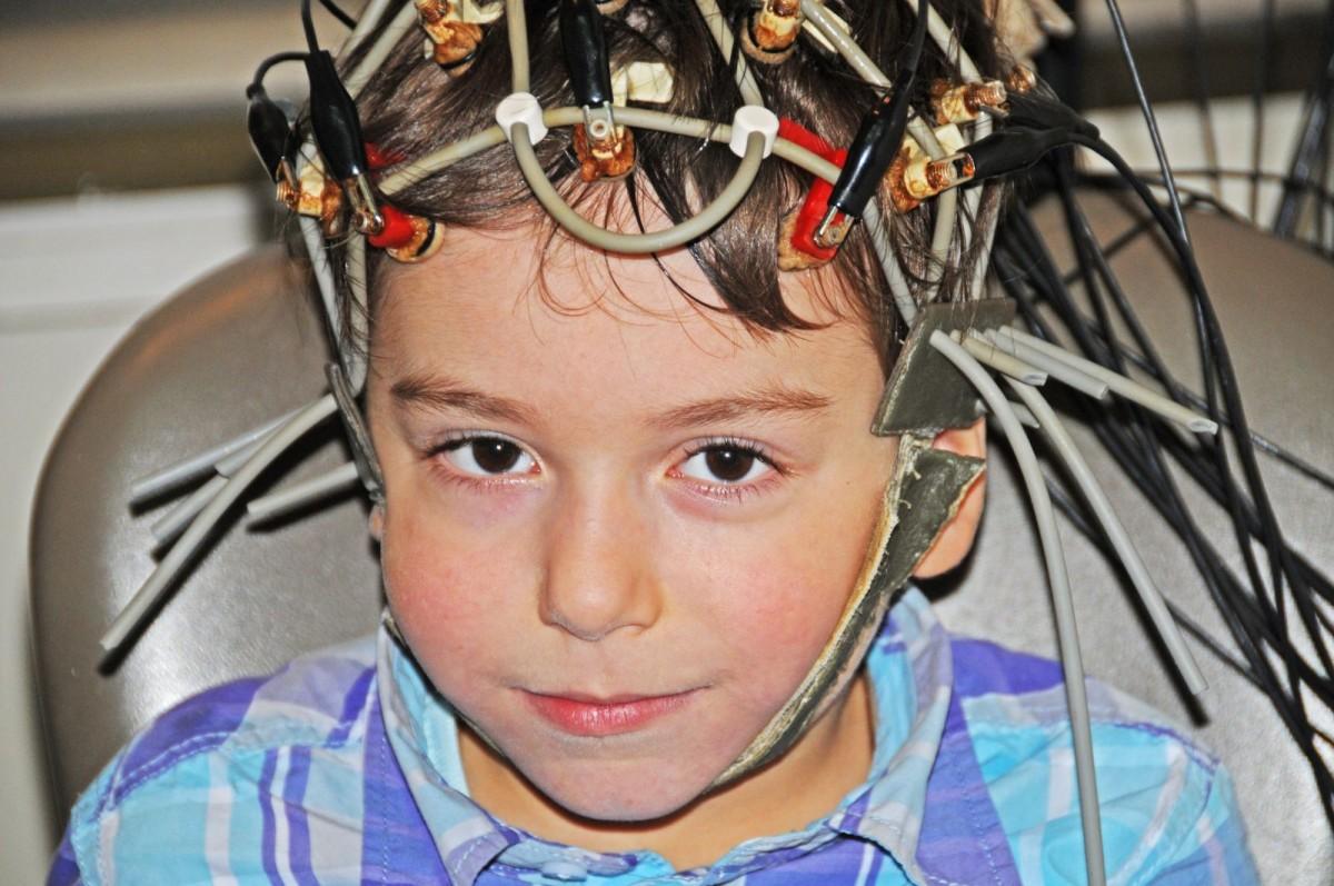 ЭЭГ головного мозга