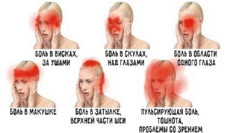 Локализация боли