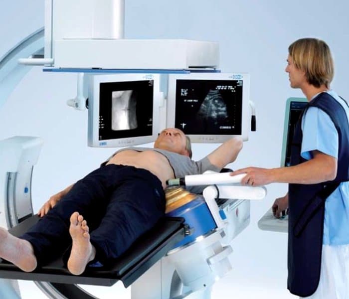 Рентгенография